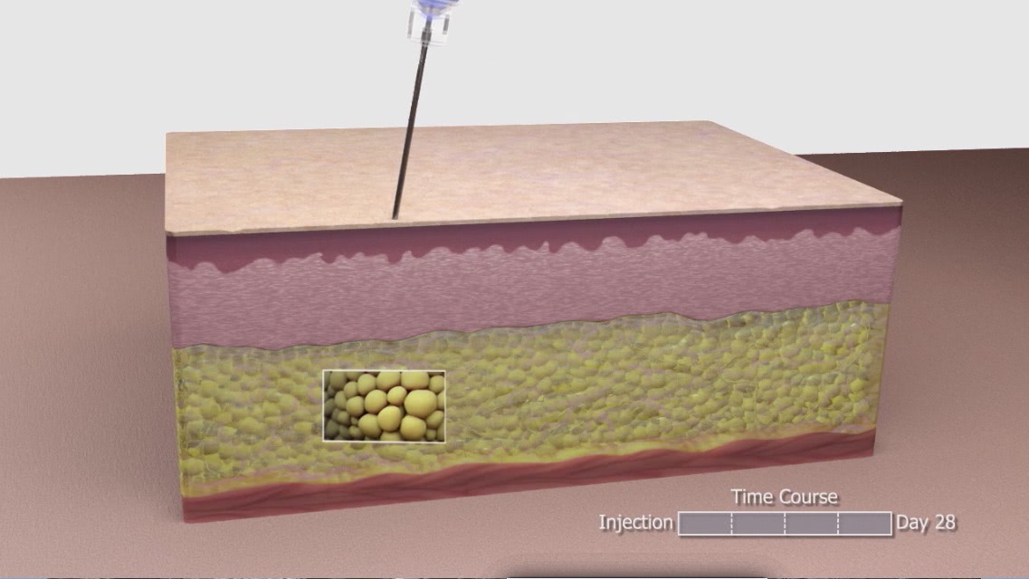 Kythera | Video: How drug KTX-101 works in the body - TBA Digital
